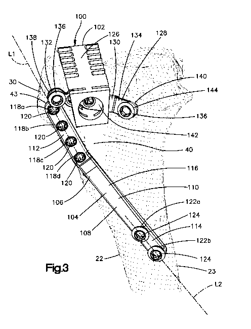 A single figure which represents the drawing illustrating the invention.